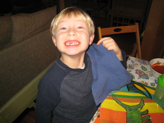 Tim tooth gap (01-04-2010 17:02)