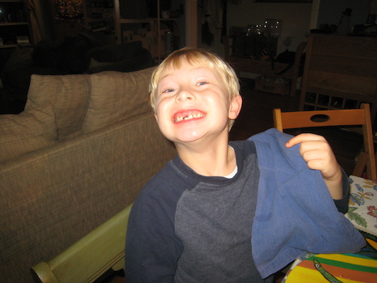 Tim tooth gap (01-04-2010 17:02)