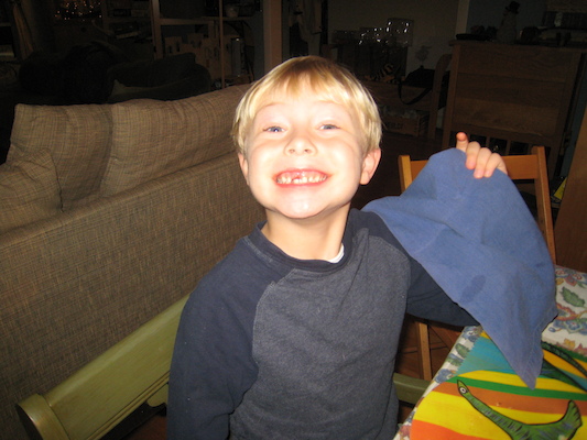 Tim tooth gap (01-04-2010 17:03)