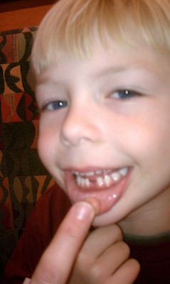 Cole's missing tooth (12-04-2010 16:31)