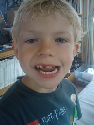 Cole with a missing tooth (07-11-2011 17:57)