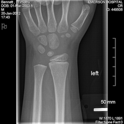 EXP0000 (01-20-2012 17:52)