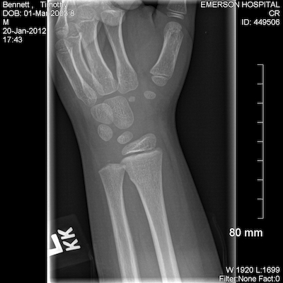 EXP0001 (01-20-2012 17:52)