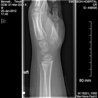 EXP0002 (01-20-2012 17:52)