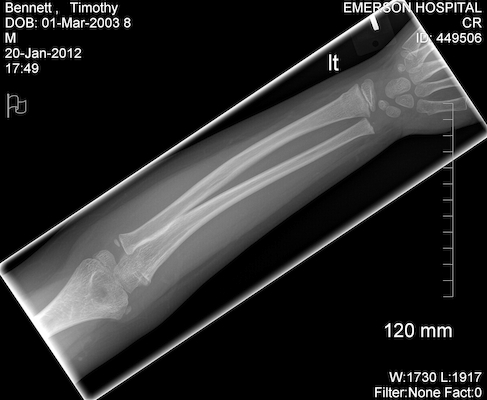 EXP0003 (01-20-2012 17:52)