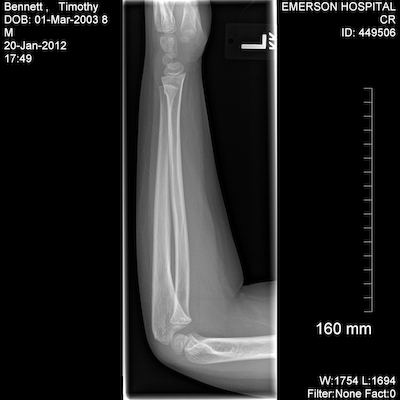 EXP0004 (01-20-2012 17:52)