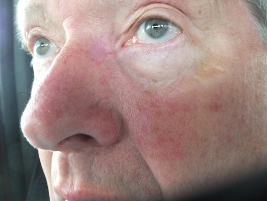 DSCF9826 (08-21-2014 17:18)