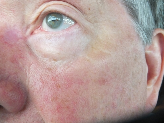 DSCF9828 (08-21-2014 17:18)