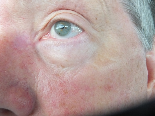 DSCF9829 (08-21-2014 17:18)