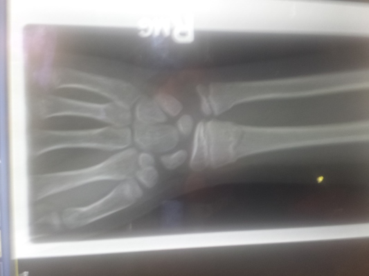 IMG_20150418_113902120 (04-18-2015 11:39)