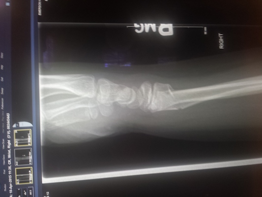 IMG_20150418_113906585 (04-18-2015 11:39)