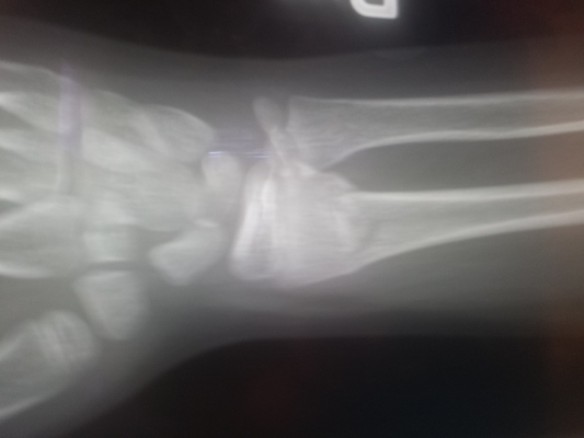 IMG_20150418_113919127 (04-18-2015 11:39)