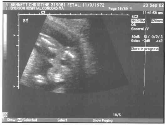 ben1gs (9-24-2002 8:36)