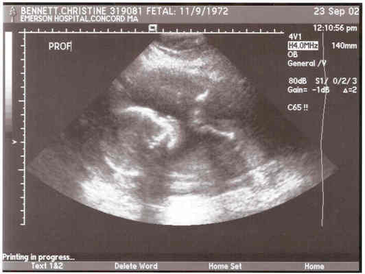 Baby Ultrasound 2