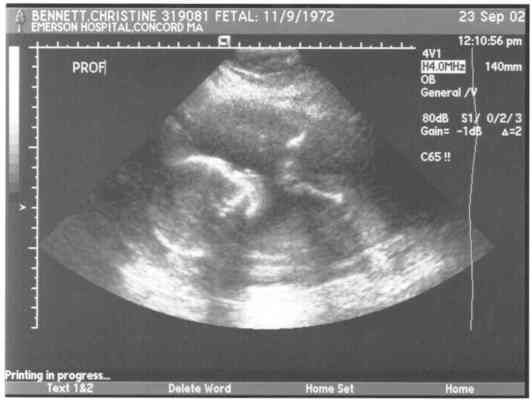 ben2gs (9-24-2002 8:41)