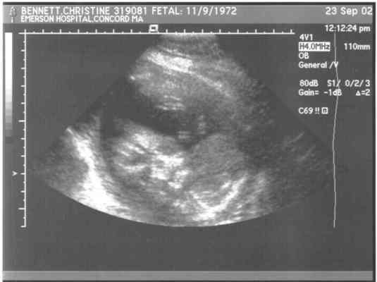 ben3-gs (9-24-2002 9:2)