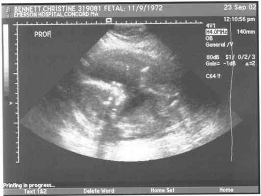 ben5gs (9-24-2002 9:15)