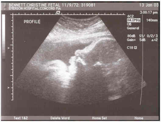 Ultrasound (profile)
