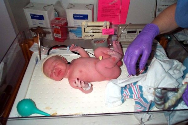 Stoic while the cord is removed (3-1-03 6:14AM)