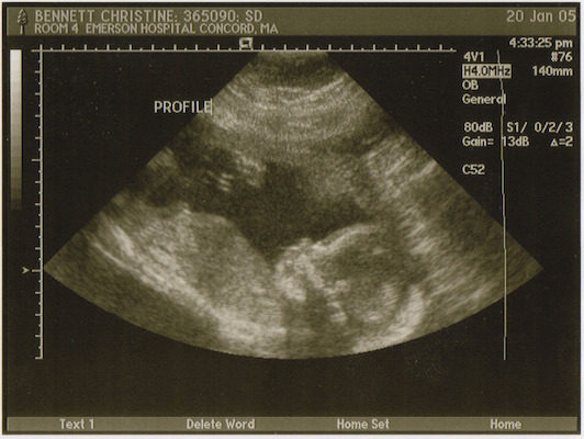 Ultrasound (01-20-2005 16:33)