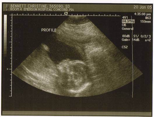 Ultrasound (01-20-2005 16:33)
