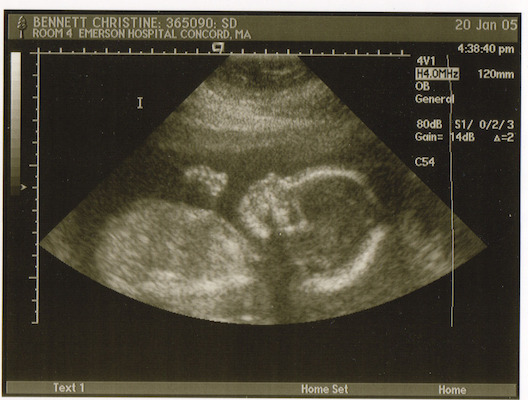 Ultrasound (01-20-2005 16:33)