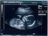January 2005: Ultrasound Pics